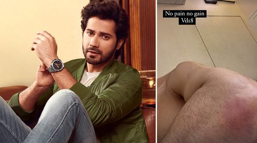 Oh No! VD18: Varun Dhawan Gets INJURED During Shoot For Upcoming Film; Says, 'No Pain No Gain!' (View Pic)