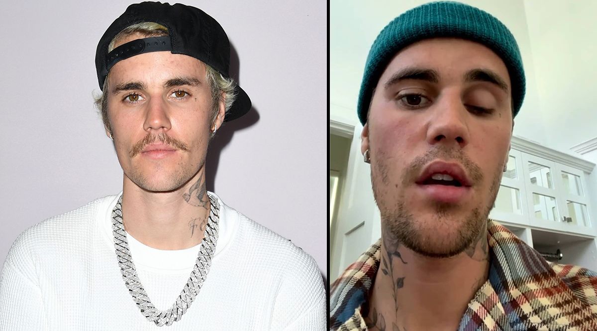 Despite Having Partial Facial Paralysis, Justin Bieber Manages To Grin A Little Bit And Uploads A Video