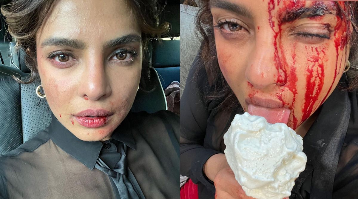 Priyanka Chopra's recent picture from the sets of Citadel isn’t for the weak-hearted