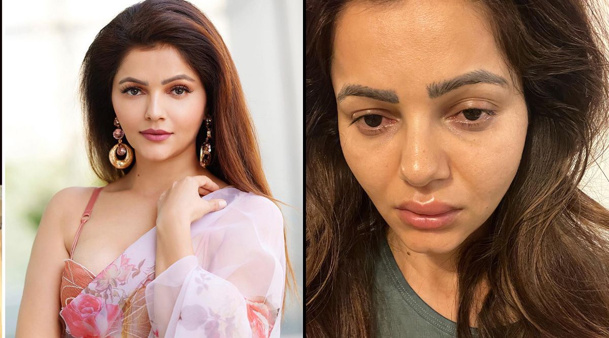 Bigg Boss 14 winner Rubina Dilaik shares shocking pictures of her swollen face; SEE PIC!