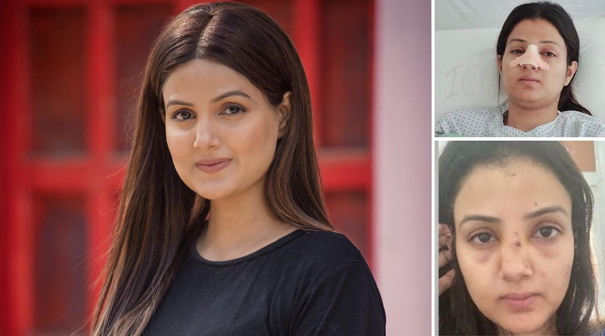 Kismat Ki Lakiro Se Actress Sumati Singh OPENS UP About Going Through A Nose Surgery After A Devastating Incident; Says, “Every Morning I Used To Hide In A Bathroom..’   