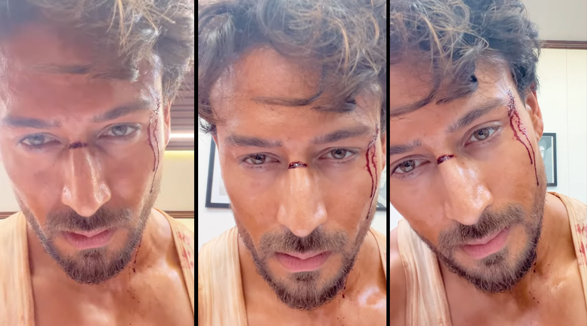 Tiger Shroff Injured? A recent video post with an action sequence hints so