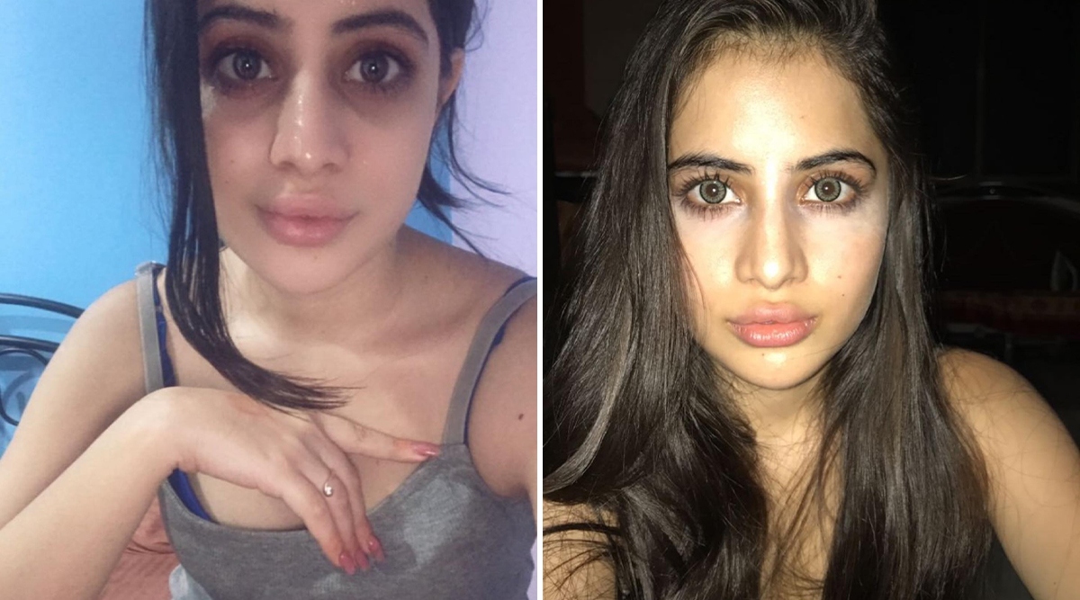 Uorfi Javed's JAW-DROPPING Lip Filler Journey; From Painful Mistakes To Perfect Pout! (View Post)