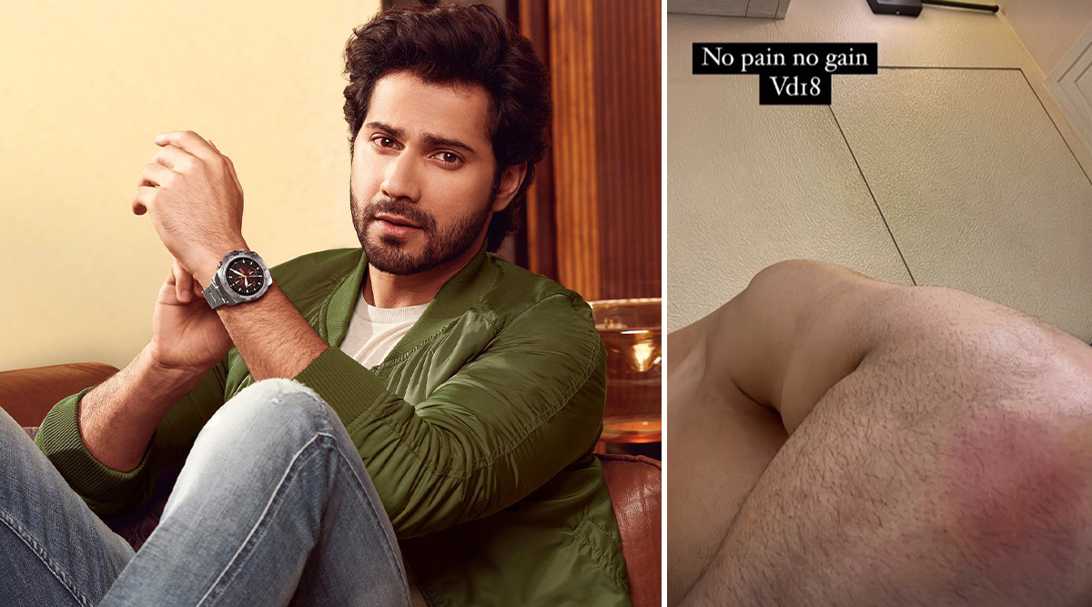 Oh No! VD18: Varun Dhawan Gets INJURED During Shoot For Upcoming Film; Says, 'No Pain No Gain!' (View Pic)